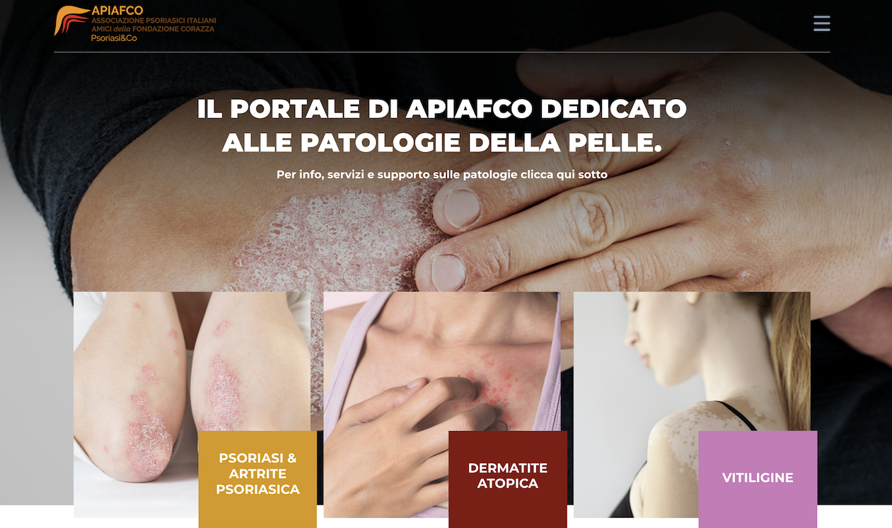Malattie croniche della pelle: nel sito di APIAFCO tutte le info utili ai pazienti