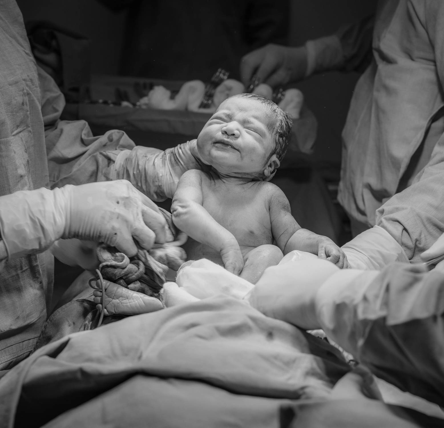 Malattie rare, un nuovo test del sangue accelera la diagnosi nei neonati