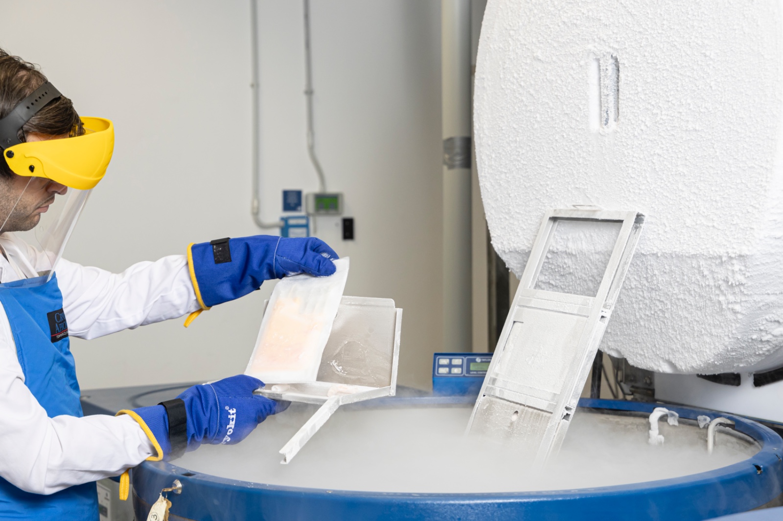 Tumore al seno: ricostruzione più naturale con trapianto del tessuto adiposo crioconservato