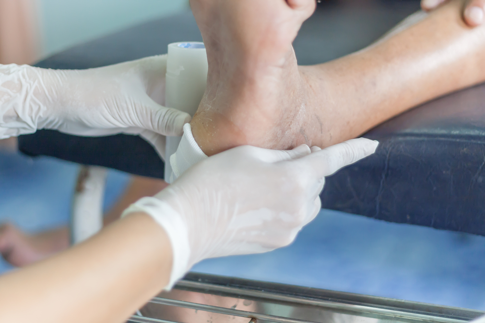 Piede diabetico grave, combinazione di farmaci promette di ridurre amputazioni